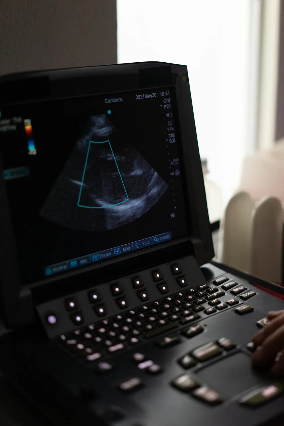 Ultrasonido cardíaco usado para realizar ecocardiograma