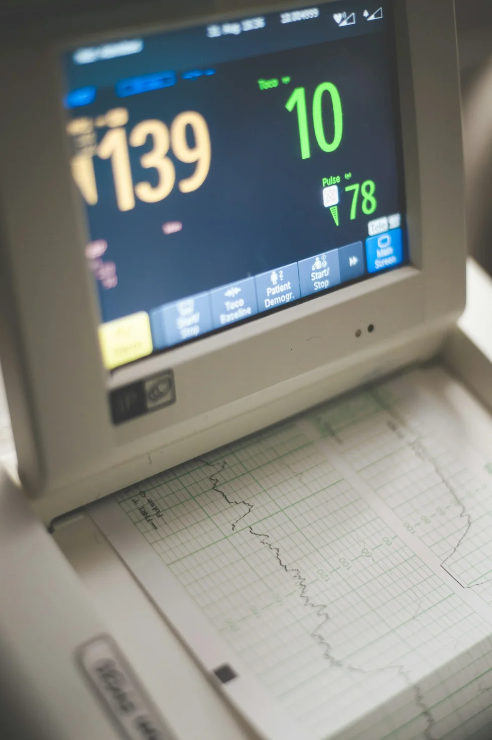 Equipo para electrocardiograma en evaluación del corazón